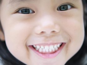 子供のガミースマイルはいつから歯列矯正するといいの？