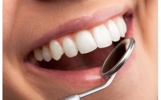 大人の歯並び矯正の費用・期間・種類