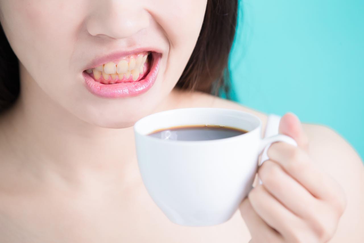 歯の黄ばみの原因と黄ばんだ歯にならないための対策と対処法