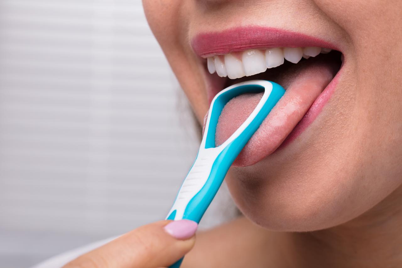 口臭の原因 舌苔 とは 取り方のコツ 美歯ラボ いい歯医者