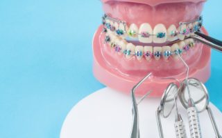 歯列矯正の歴史から未来の矯正治療を予測