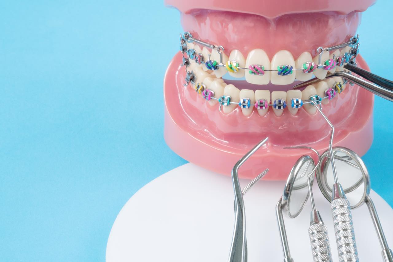 歯列矯正の歴史から未来の矯正治療を予測