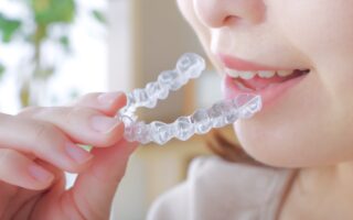 インビザラインは抜歯症例も対応できる？抜歯する場合のメリットやデメリットも解説