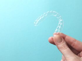 差し歯(被せ物)が入っていてもマウスピース矯正はできるの？