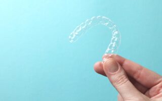 差し歯(被せ物)が入っていてもマウスピース矯正はできるの？