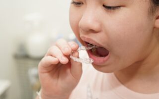 子供のマウスピース矯正はいつからできるの？