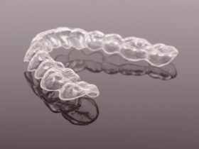 マウスピース矯正の値段はどこが安い？費用を抑えるコツを解説