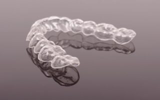 マウスピース矯正の値段はどこが安い？費用を抑えるコツを解説