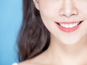 前歯の歯並びを改善する歯列矯正の種類